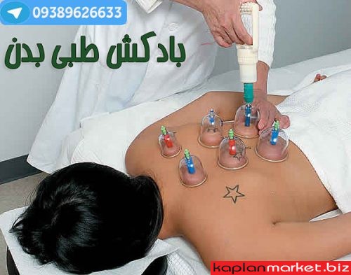 خرید پستی دستگاه بادکش و رفع خستگی, حجامت