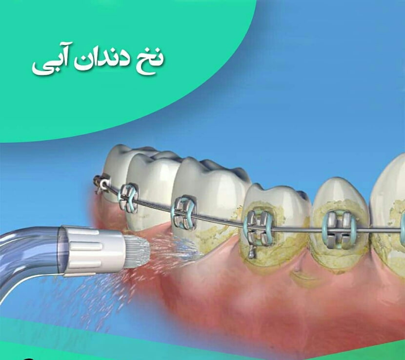 خرید ارزان پاورفلاس اصلی power floss