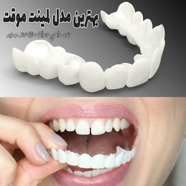 خرید اینترنتی بهترین مدل لمینت دندان دوفک