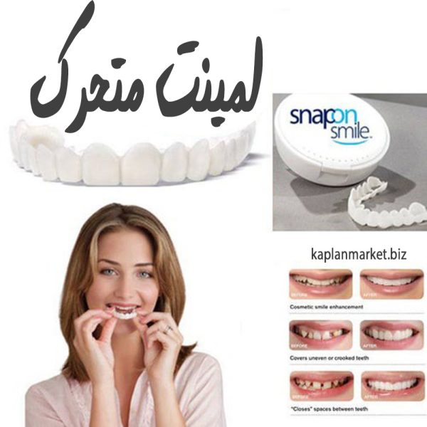 قیمت روکش مصنوعی دندان و قیمت لمینت موقت و کامپوزیت متحرک