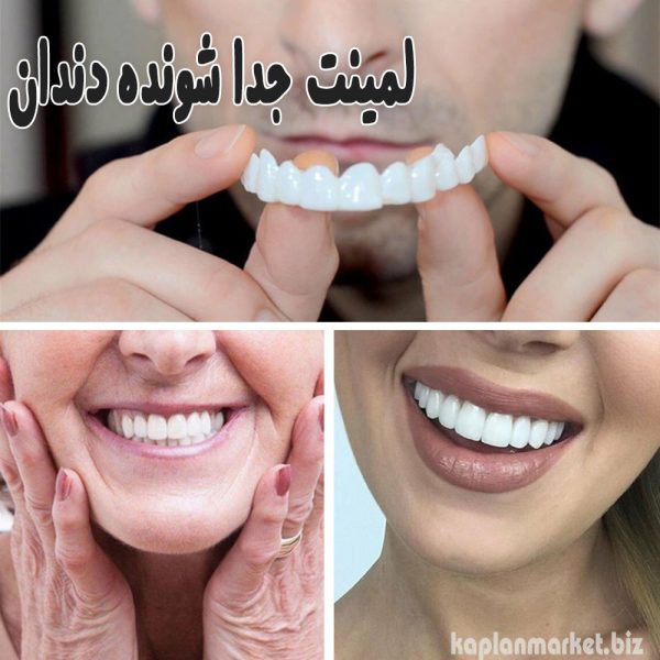 خرید لمینت جدا شونده دندان با تخفیف طلایی کاپلان مارکت