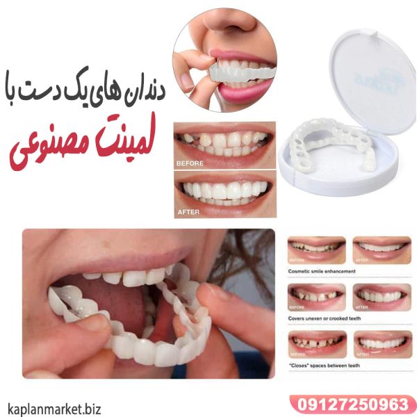 دندان های یک دست با لمینت متحرک دندان ترو اسمایل اصل True Smile